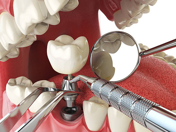 Best Emergency Cosmetic Dentistry (e.g., broken veneers) in Wilder, ID